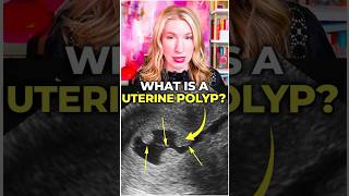 Have You Heard Of A Polyp? Wealth