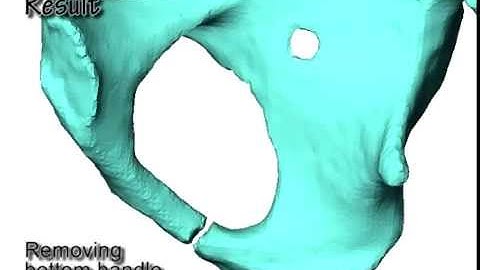 Editing The Topology of 3D Models by Sketching