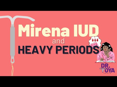 Mirena IUD for Heavy Periods