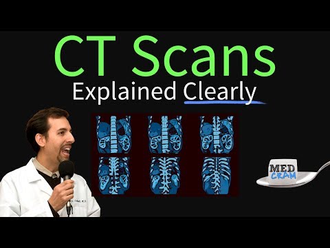 Video: CT scan - what kind of examination is it and what is it for