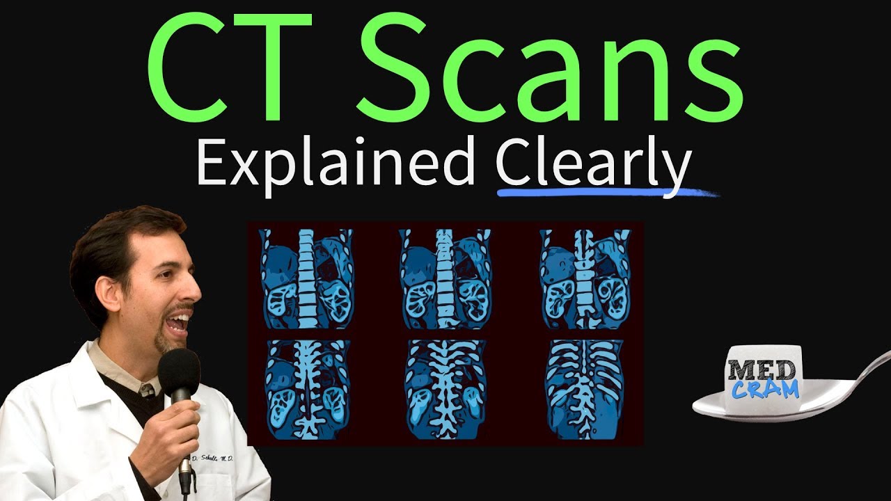 CT Scan of the Chest Explained Clearly - High Resolution CT Scan (HRCT)