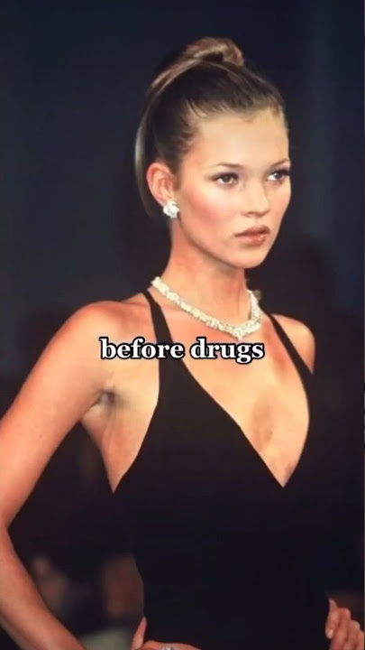 Before Drugs & After #Katemoss #model #catwalk #shortfeed #supermodel #celebrities