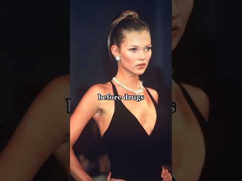 Before Drugs x After Katemoss Model Catwalk Shortfeed Supermodel Celebrities