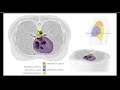 [Biocord Winter Conference] The Anatomy of the Heart