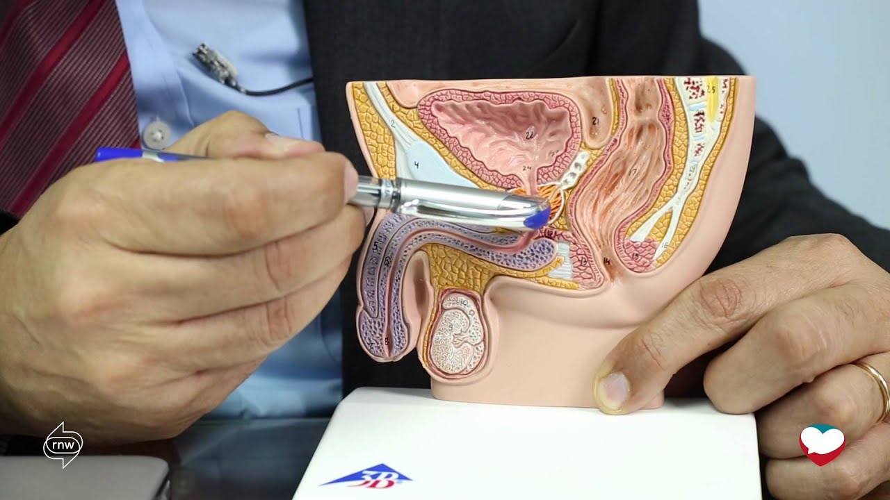 5  Delayed and retrograde ejaculation   القذف المتأخر والقذف المرتجع