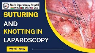 Mastering Laparoscopic Continuous Suturing: Expert Demonstration by Dr. R. K. Mishra