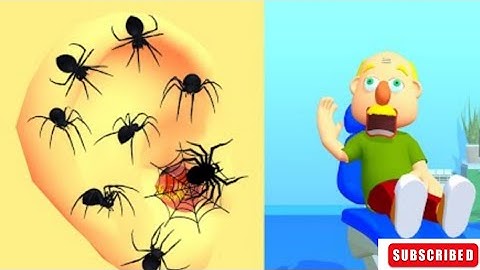 Earwax Clinic Game 3D New Max Level Gameplay Walkthrough Update Trailer iOS, Android Mobile Game