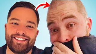Why GOING BALD Hit Me So Hard - The Full Story
