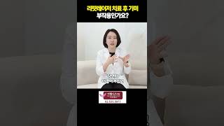 리팟레이저 치료 후 기미 부작용 인가요?! #리팟레이저 #흑자재발 #색소침착