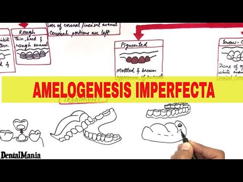 Amelogenesis Imperfecta - Pathogenesis, Types, Clinical features and Treatment