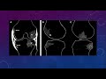 mri interpretation of sport related knee injuries