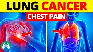 Chest Pain and Lung Cancer | EXPLAINED ⚠️