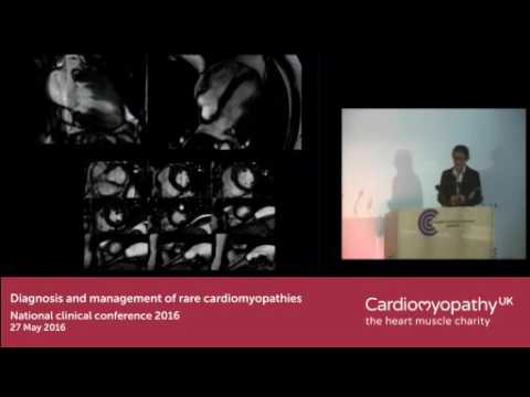 Treatment options in myocarditis - YouTube