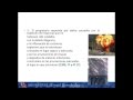 Lec014  Responsabilidad civil extracontractual  (umh1192sp 2013-14)