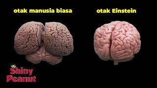 Inilah yang Membuat Albert Einstein Berbeda dari Manusia Normal