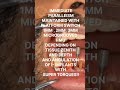 IMMEDIATE SCREW RETAINED ZIRCONIA PROSTHESIS: *IPL: IMMEDIATE PROGRESSIVE LOADING*