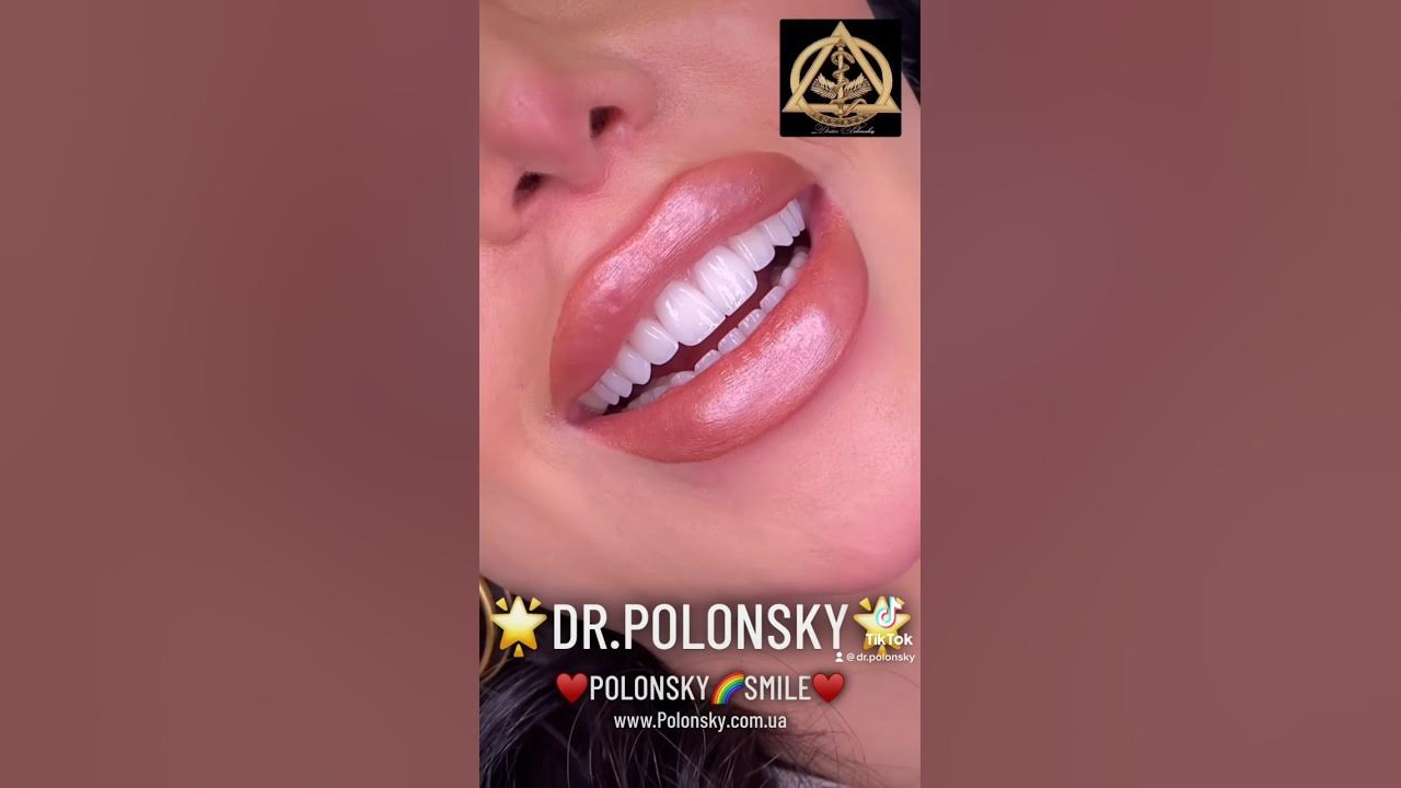 Стоматолог Одесса Доктор Полонский Стоматологія Одеса Вініри #Одеса # ...