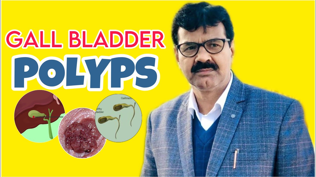 Gall Bladder Polyps Explained by Dr. ZA Ansari - YouTube