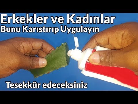 Geceleri 1 Kez Karıştırırsanız Bana 100 Kez Teşekkür Edersiniz Aloe vera ve Diş Macunu Karışımı