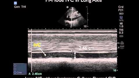 How To: RUSH Exam Video Part 3 Case Study Video