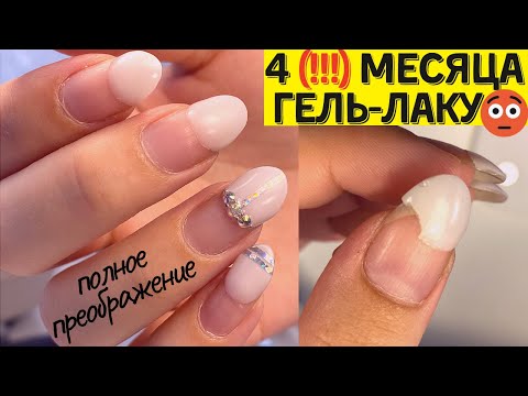 Почему НЕЛЬЗЯ перенашивать ГЕЛЬ ЛАК!!! Маникюру 4 месяца 😵 Дизайн ногтей