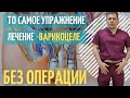 Лечение варикоцеле без операции // Упражнение для вен семенного канатика