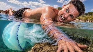 La Pire Douleur ? Méduse Vs Vive