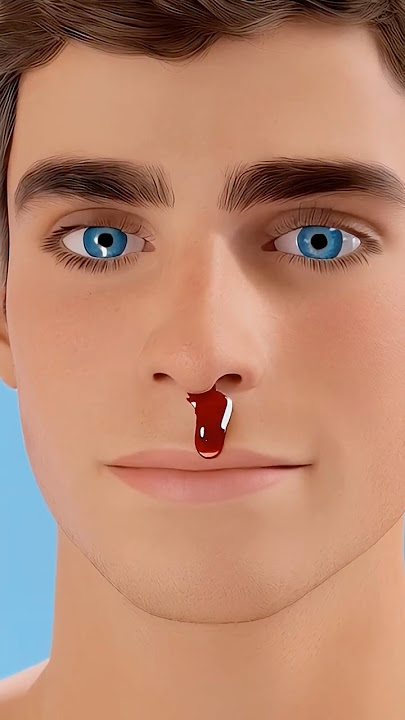 If Your Nose Starts To Bleed