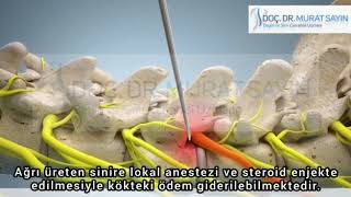 Murat Sayın-11