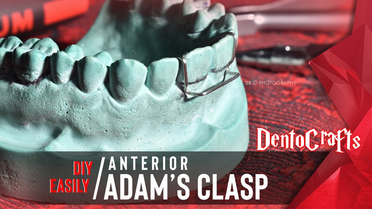 [DIY EASILY] ANTERIOR ADAM'S CLASP PRECLINICAL ORTHODONTICS DENTISTRY YouTube