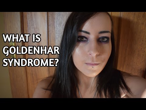 ゴールデンハー症候群とは何ですか？