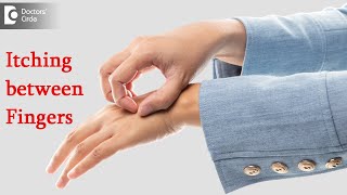 Itching between fingers : Finger Webspace Area | Cause & Cure -Dr. Rashmi Ravindra | Doctors' Circle