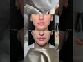 Процедура стимулирует выработку собственного коллагена,эластина, подтягивает кожу, уменьшает морщины