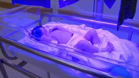 Newborn Jaundice