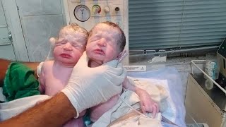 New born baby twins both are brothers and both are male very active clean both baby with oil🥰