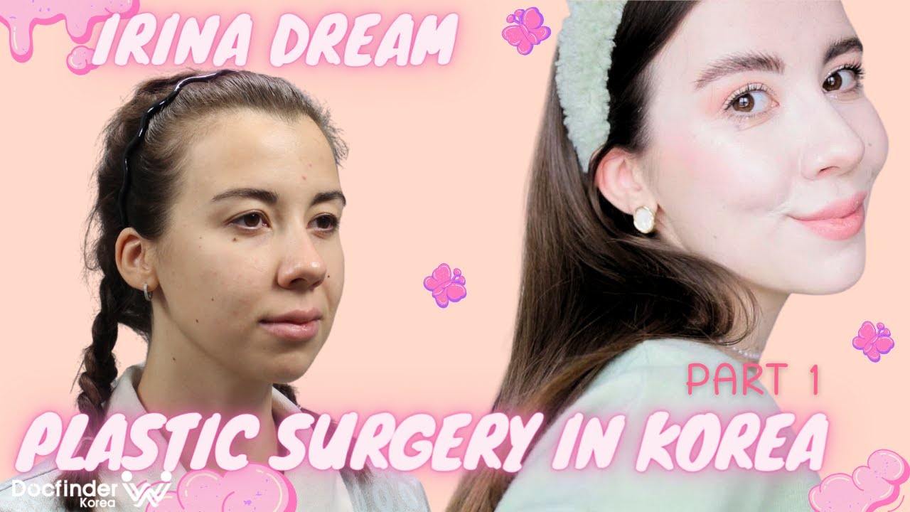 Plastic surgery in Korea Upper Blepharoplasty, Chin implant, Fat graft