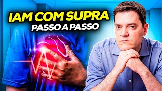 IAM with Supra: Step-by-Step Prescription in the Emergency Room