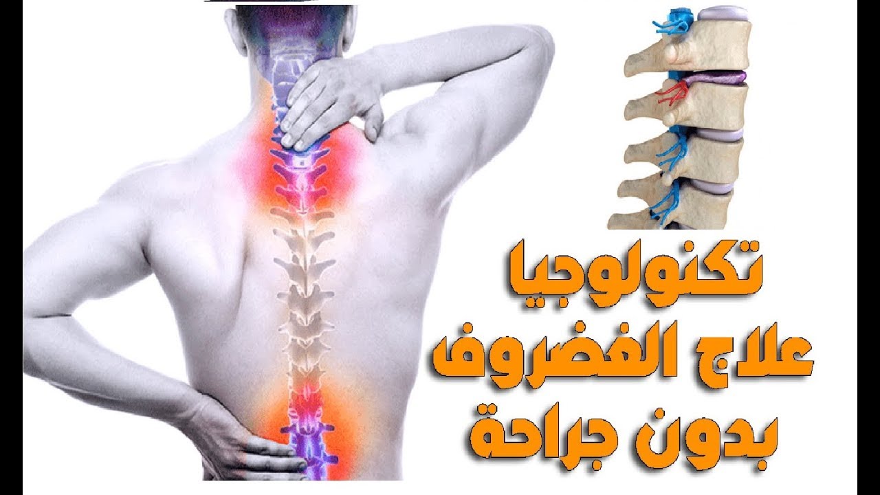 تكنولوجيا علاج الغضورف بدون جراحة في مركز آسيا كلينك مع الدكتور وليد عمار