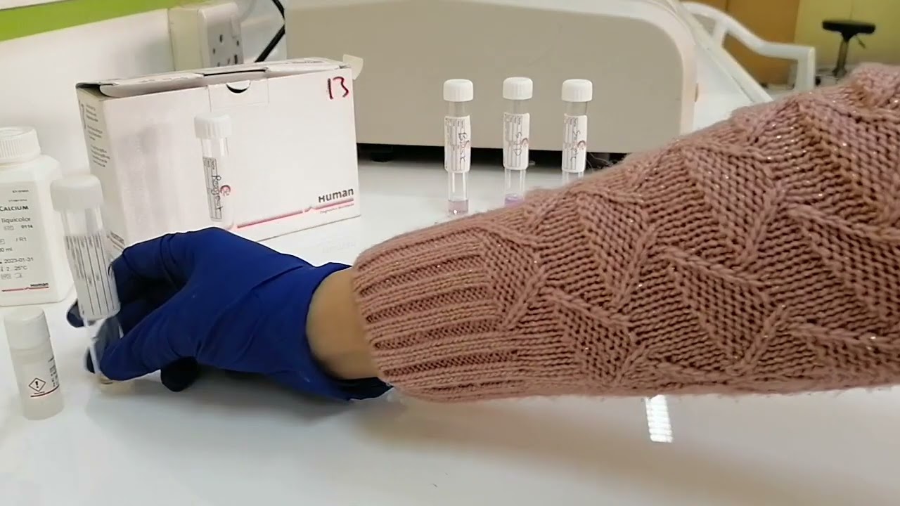 Determination of Calcium in the blood