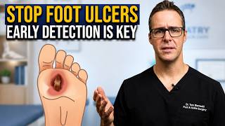 The Truth About Diabetic Foot Ulcers: Causes & Treatments