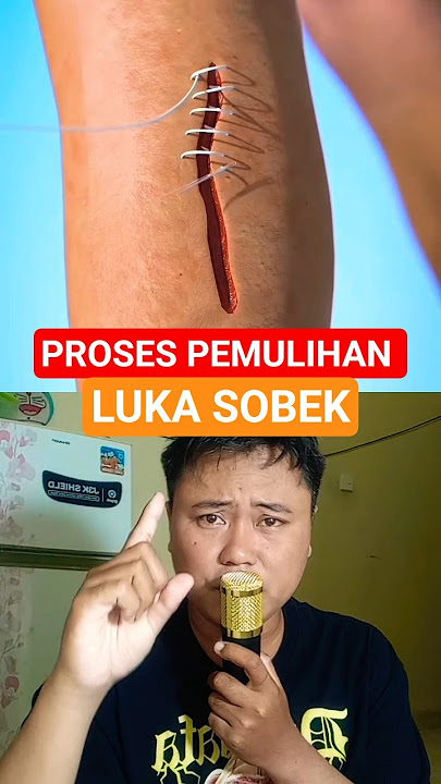 The process of healing a torn wound on the foot😱 #science #doctor #anatomy