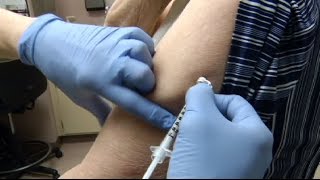 Health Check: Allergy season comes early