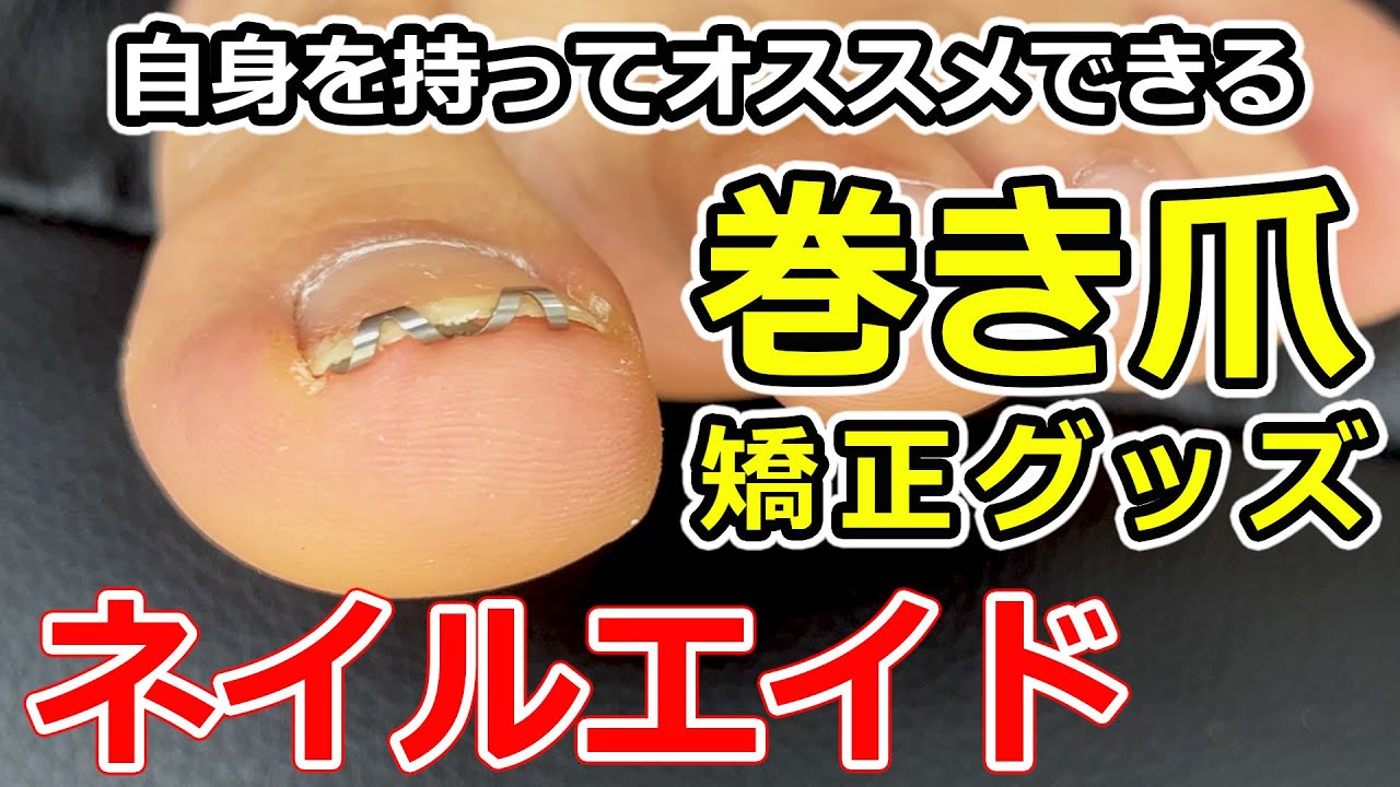 ネイル・エイド NailAid 巻き爪矯正用 2個セット 最 安値 でDiet