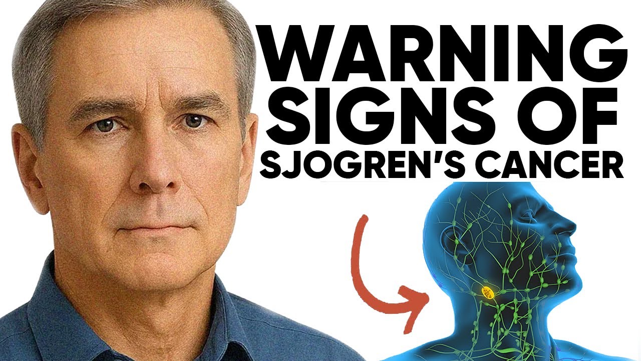 Sjögren’s Cancer Symptoms & Early Warning Signs You CANNOT Ignore Could Save Your Life