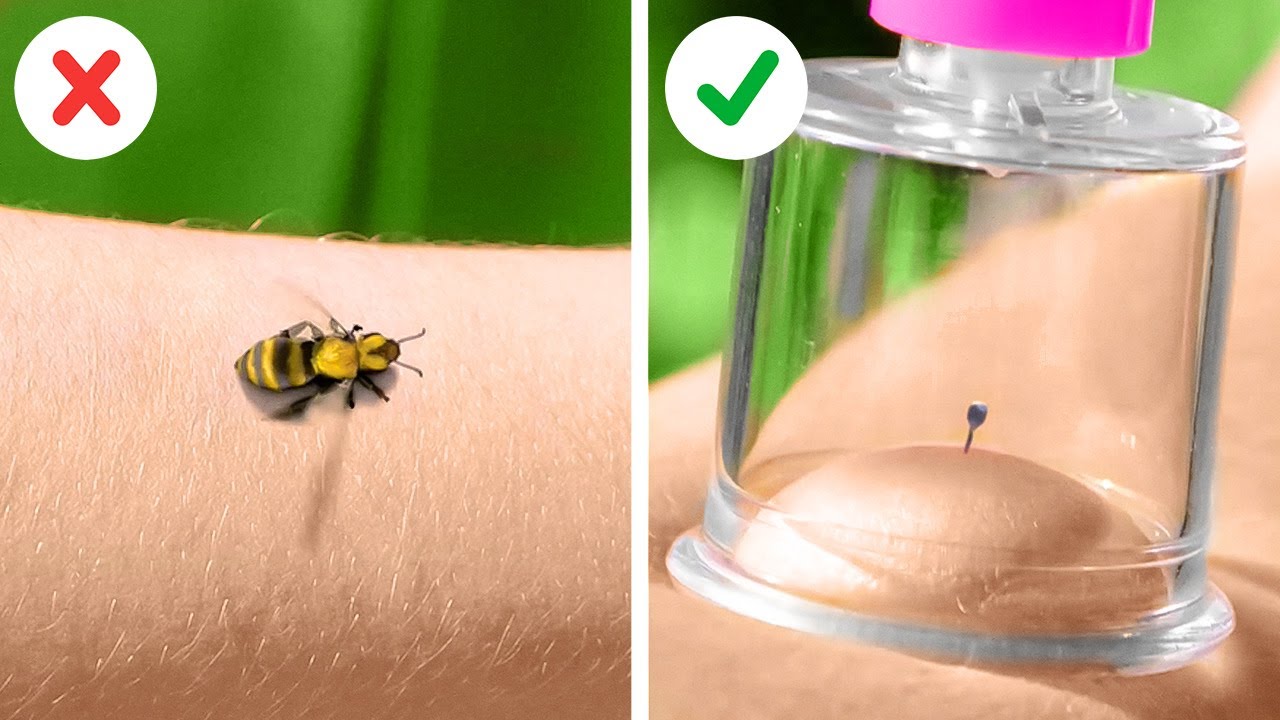 TRUCCHI DI PRIMO SOCCORSO || Soluzioni semplici per problemi comuni