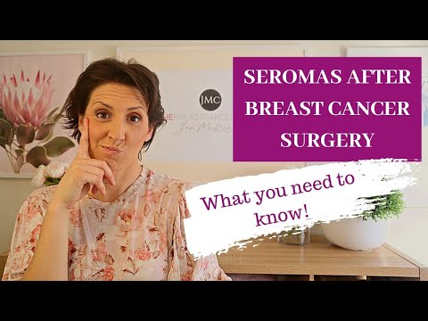 SEROMAS AFTER BREAST CANCER SURGERY: What you need to know!