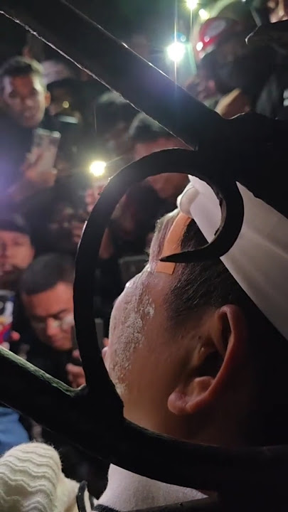 KDM's face was hit by a stone, but he remained calm and engaged in dialogue with the demonstrators.