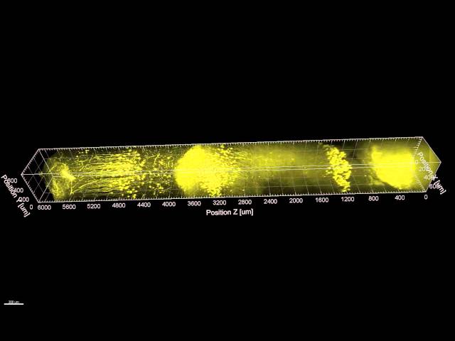 Deep imaging of mouse brain tissue class=