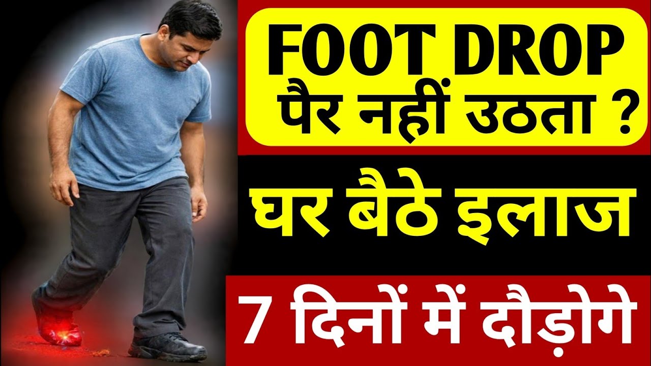 पैर उठता नहीं?(Foot Drop), पंजों का लकवा को अब घर बैठे ठीक करें|Drop Foot Exercises