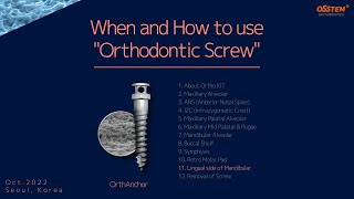 11. Lingual side of the Mandible (When and How to use Orthodontic Screws)